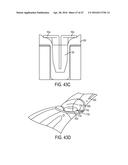 Biceps Tenodesis Implants and Delivery Tools diagram and image