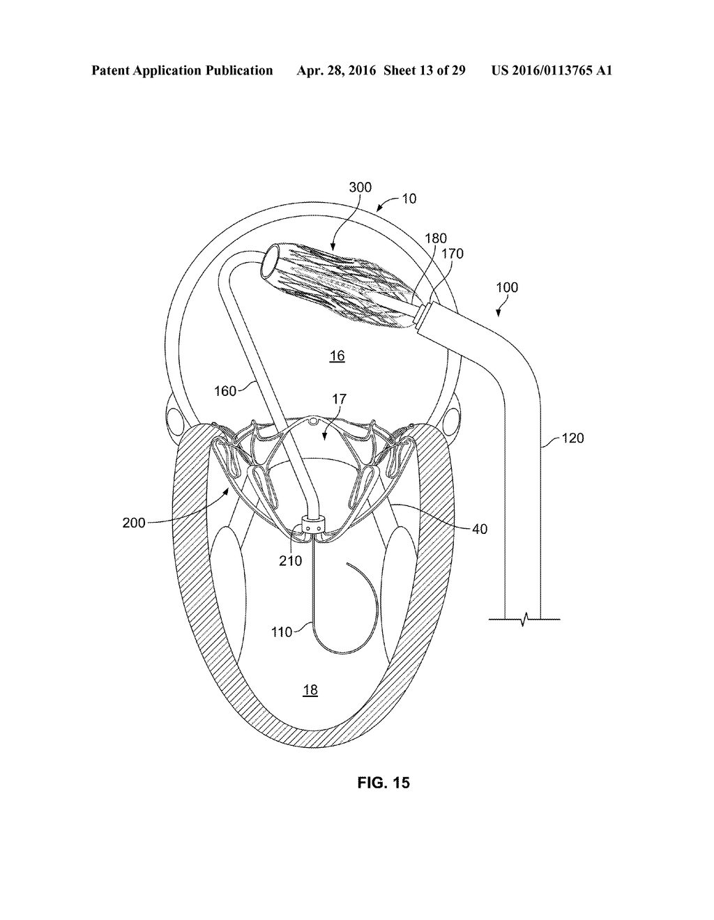 SYSTEMS AND METHODS FOR HEART VALVE THERAPY - diagram, schematic, and image 14