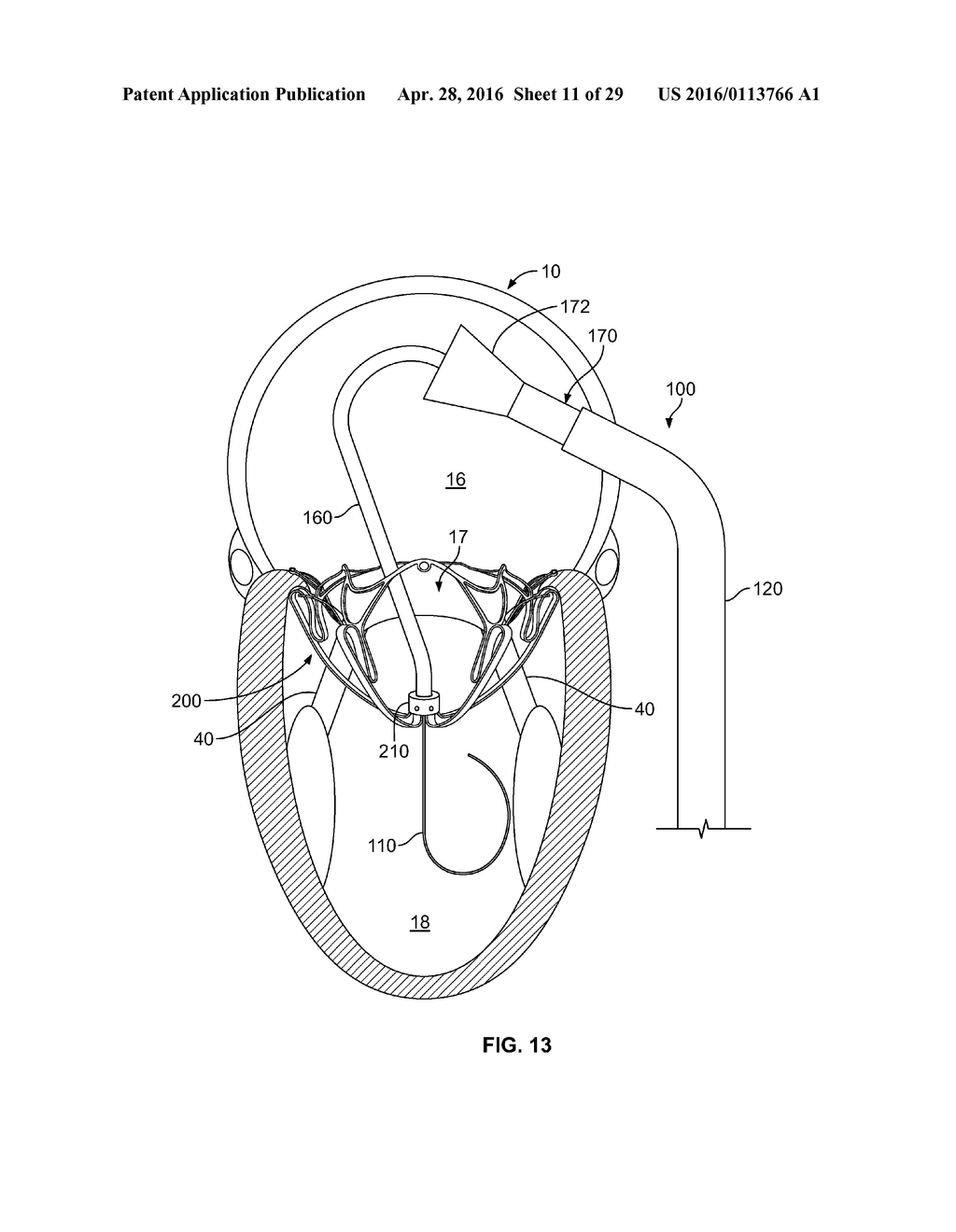 SYSTEMS AND METHODS FOR HEART VALVE THERAPY - diagram, schematic, and image 12