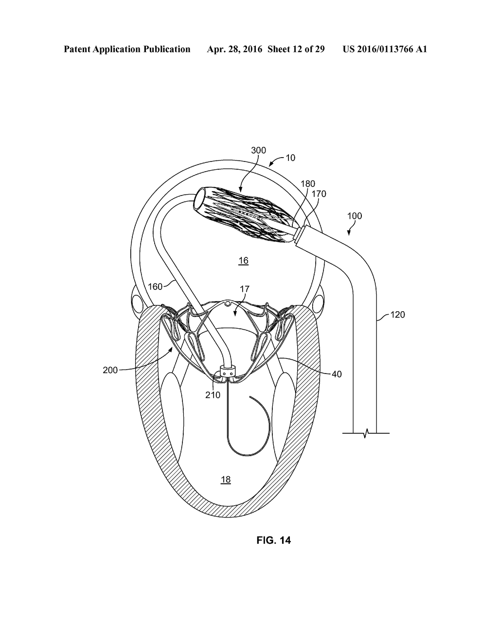 SYSTEMS AND METHODS FOR HEART VALVE THERAPY - diagram, schematic, and image 13