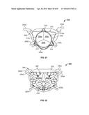 SYSTEMS AND METHODS FOR HEART VALVE THERAPY diagram and image