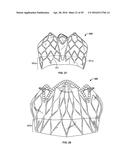 SYSTEMS AND METHODS FOR HEART VALVE THERAPY diagram and image