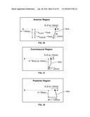 SYSTEMS AND METHODS FOR HEART VALVE THERAPY diagram and image