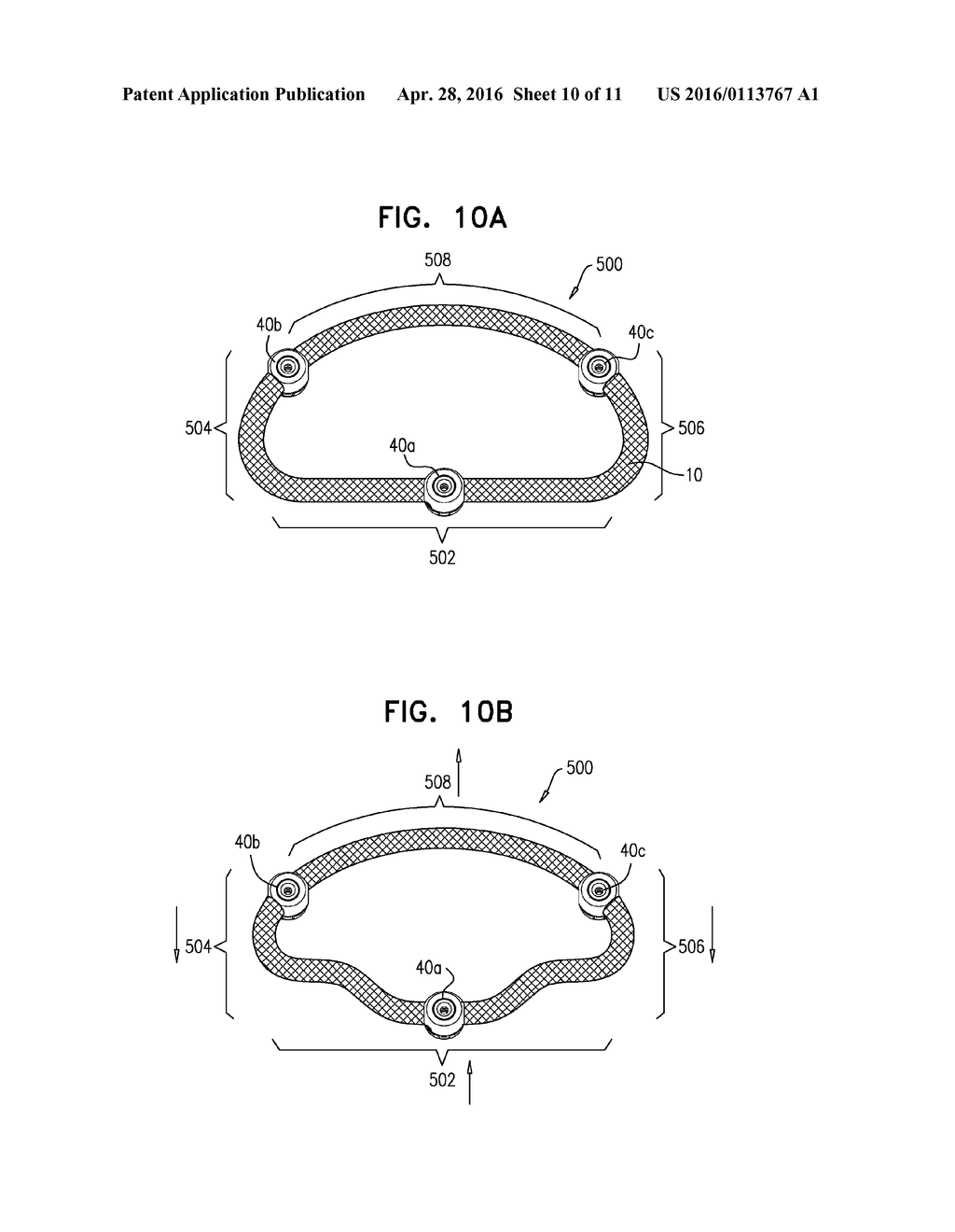 IMPLANT HAVING MULTIPLE ROTATIONAL ASSEMBLIES - diagram, schematic, and image 11