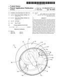 FEMORAL HEAD RESURFACING IMPLANT diagram and image