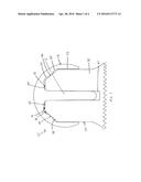 FEMORAL HEAD RESURFACING IMPLANT diagram and image