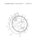 FEMORAL HEAD RESURFACING IMPLANT diagram and image