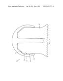 FEMORAL HEAD RESURFACING IMPLANT diagram and image