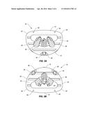 SPINAL IMPLANT CONFIGURED FOR MIDLINE INSERTION diagram and image