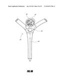 VASCULAR REMODELING DEVICE diagram and image