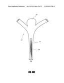 VASCULAR REMODELING DEVICE diagram and image