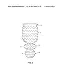 SATIATION DEVICES AND METHODS diagram and image