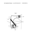 DYNAMIC HIP BRACE, HIP BRACE KIT AND METHOD OF USE diagram and image