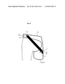 DYNAMIC HIP BRACE, HIP BRACE KIT AND METHOD OF USE diagram and image