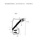 DYNAMIC HIP BRACE, HIP BRACE KIT AND METHOD OF USE diagram and image