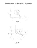 SHOES FOR CAST-WORN PATIENT diagram and image