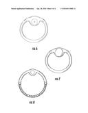 INTRAVAGINAL DEVICES FOR CONTROLLED DELIVERY OF LUBRICANTS diagram and image