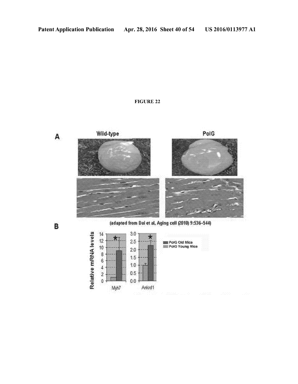 COMPOSITIONS COMPRISING SELENIUM AND USE OF SAME FOR THE TREATMENT AND     PREVENTION OF DISEASE OR CONDITIONS ASSOCIATED WITH MITOCHONDRIAL     DYSFUNCTION - diagram, schematic, and image 41