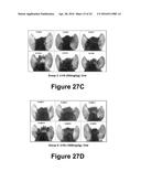 Molecular and Herbal Combinations for Treating Psoriasis diagram and image