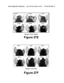 Molecular and Herbal Combinations for Treating Psoriasis diagram and image