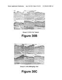 Molecular and Herbal Combinations for Treating Psoriasis diagram and image