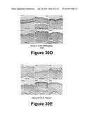 Molecular and Herbal Combinations for Treating Psoriasis diagram and image