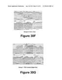 Molecular and Herbal Combinations for Treating Psoriasis diagram and image