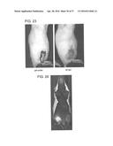 REFILLABLE DRUG DELIVERY DEVICES AND METHODS OF USE THEREOF diagram and image