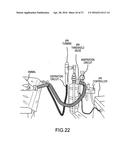 Systems and Methods for Therapeutic Intrathoracic Pressure Regulation diagram and image