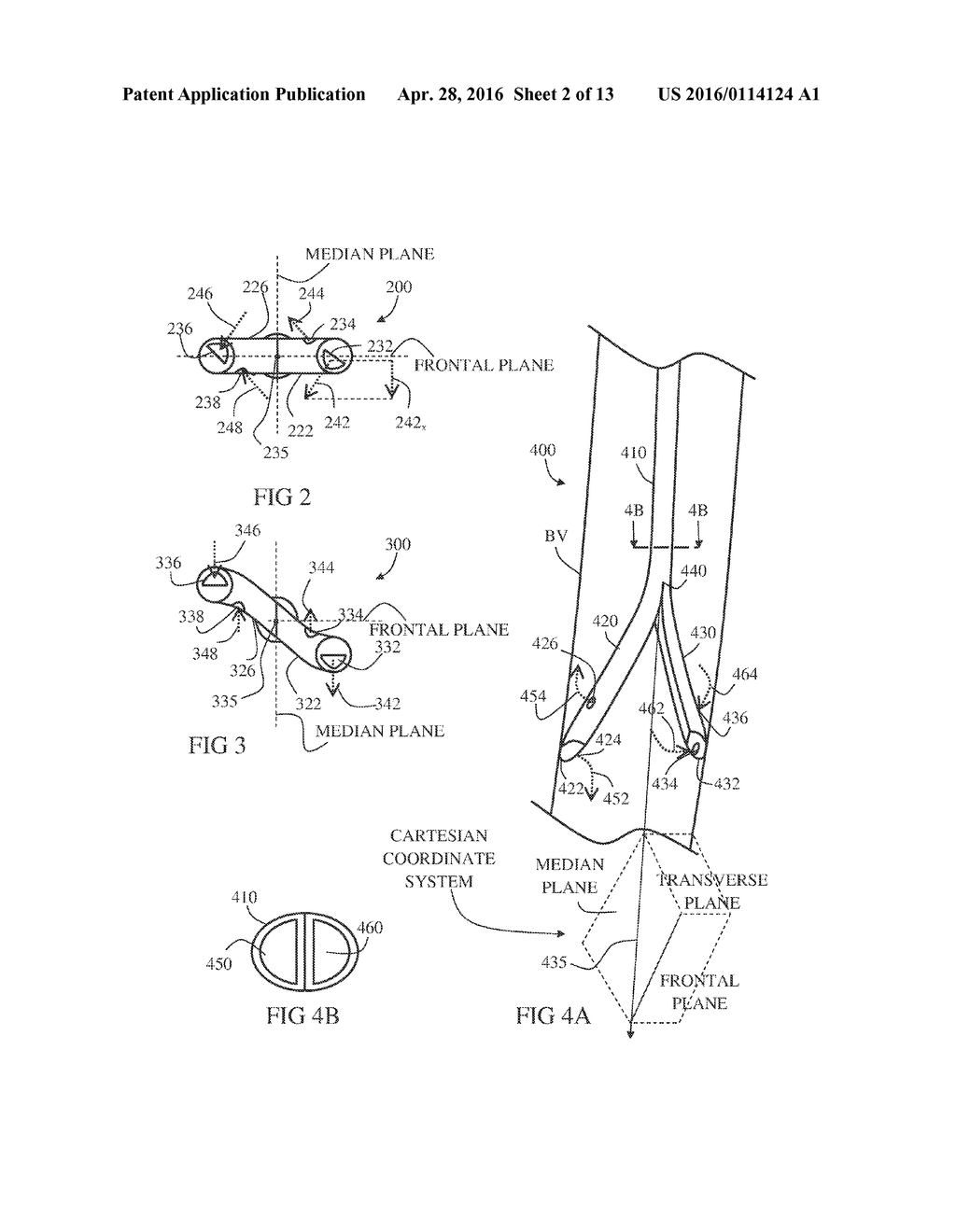 DUAL-TIP HEMODIALYSIS CATHETER - diagram, schematic, and image 03