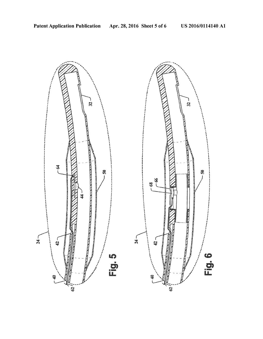 BALLOON CATHETER - diagram, schematic, and image 06