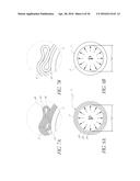 METHODS OF MANUFACTURING NESTED BALLOONS UTILIZING PRESSURIZED CONSTRAINED     ANNEALING diagram and image