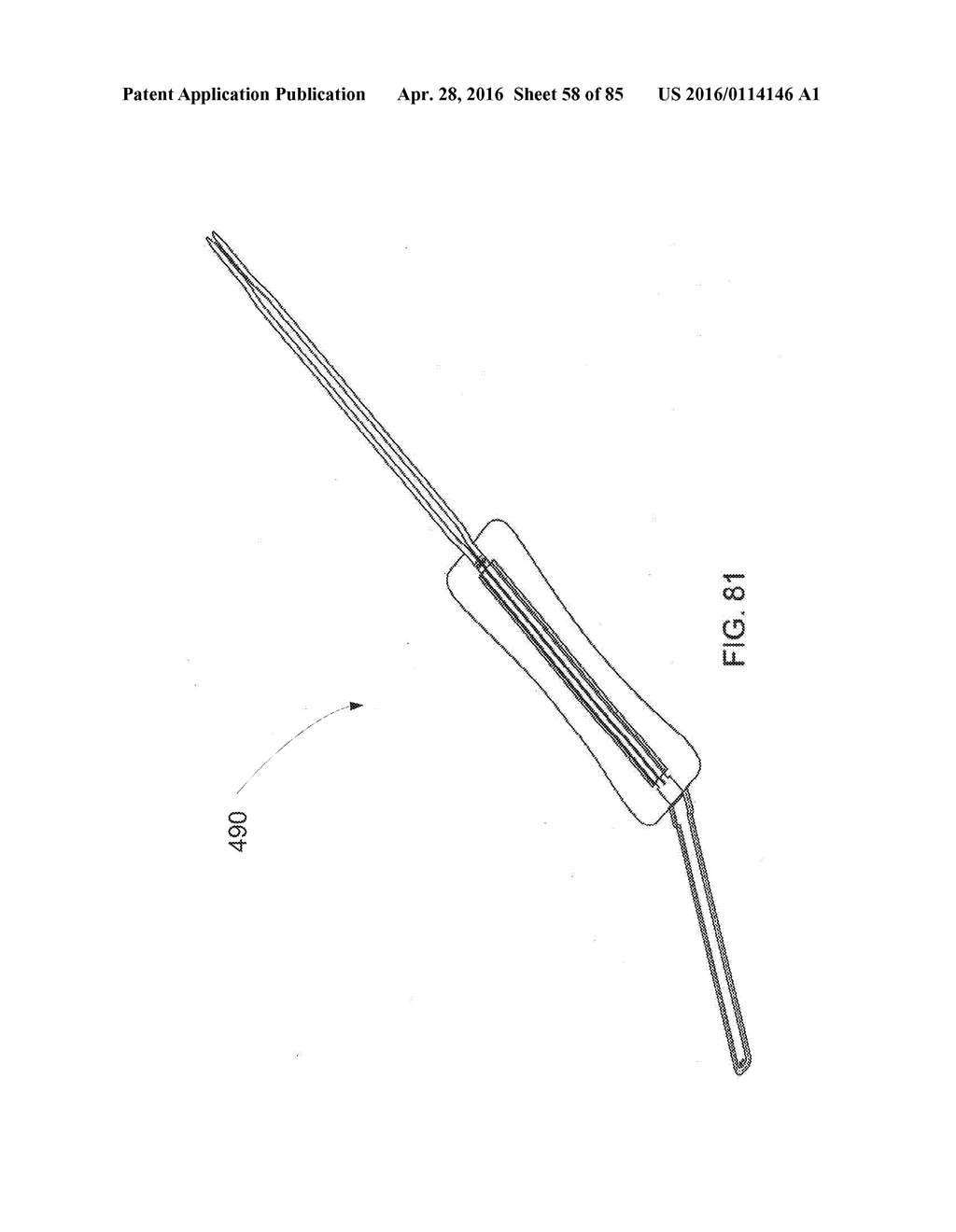 RAPID CLOSING SURGICAL CLOSURE DEVICE - diagram, schematic, and image 59