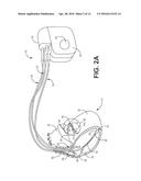 MEDICAL ELECTRICAL LEAD diagram and image