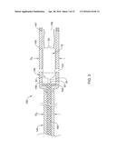 DELIVERY DEVICES AND METHODS FOR LEADLESS CARDIAC DEVICES diagram and image