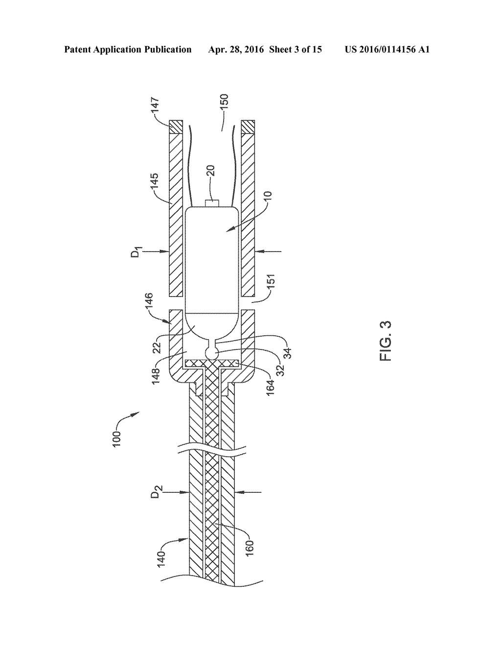 DELIVERY DEVICES AND METHODS FOR LEADLESS CARDIAC DEVICES - diagram, schematic, and image 04