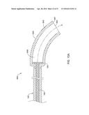 DELIVERY DEVICES AND METHODS FOR LEADLESS CARDIAC DEVICES diagram and image