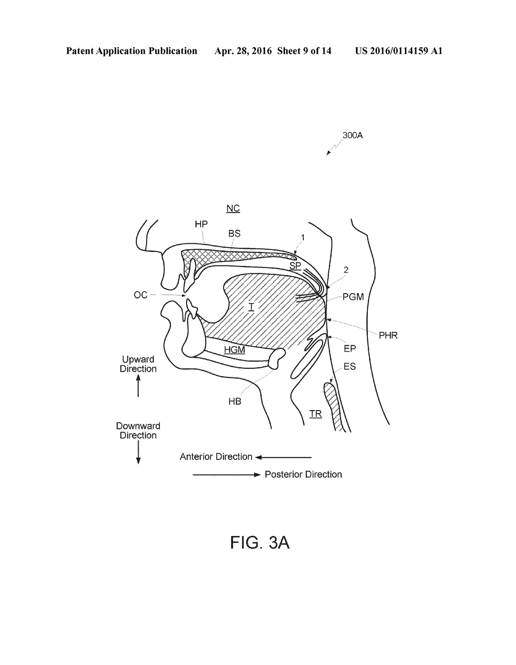 METHOD AND APPARATUS FOR TREATING SLEEP APNEA - diagram, schematic, and image 10