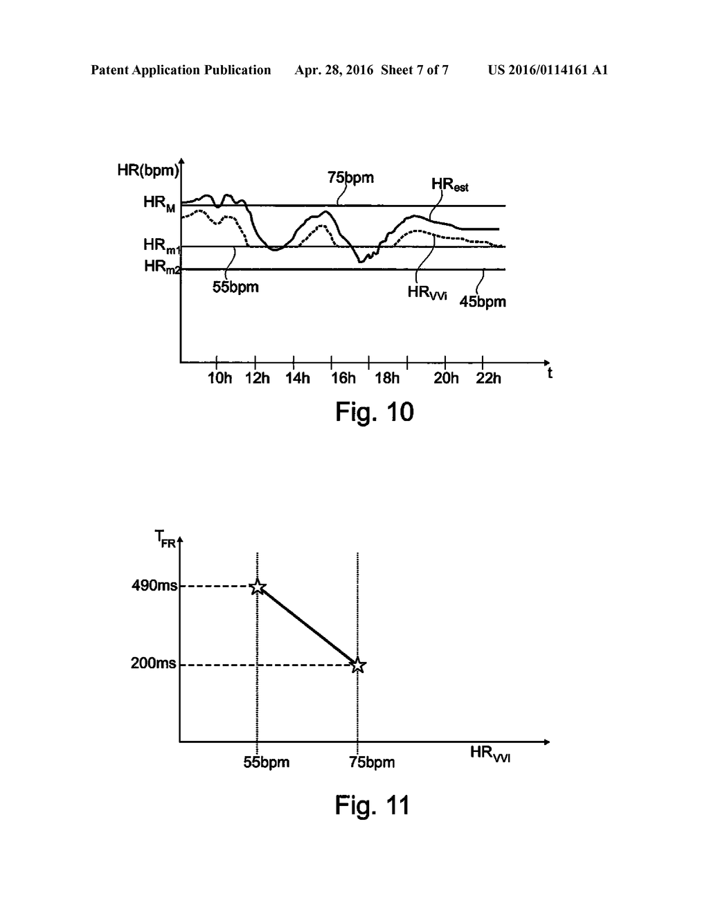 PACEMAKER WITH DETECTION OF ATRIAL ACTIVITY WITHOUT COLLECTION OF ATRIAL     ELECTRICAL ACTIVITY - diagram, schematic, and image 08