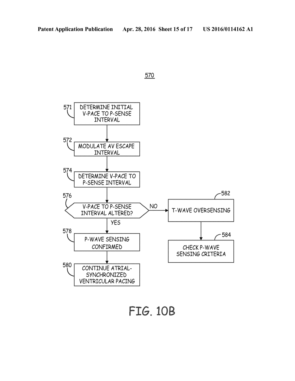 SENSING AND ATRIAL-SYNCHRONIZED VENTRICULAR PACING IN AN INTRACARDIAC     PACEMAKER - diagram, schematic, and image 16