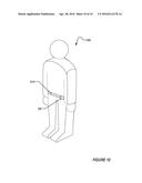 EXTERNAL TRIAL STIMULATOR USEABLE IN AN IMPLANTABLE NEUROSTIMULATOR SYSTEM diagram and image