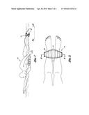 ANKLE FLOAT BUOY diagram and image