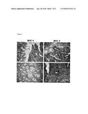 TUMOR-ASSOCIATED PEPTIDES BINDING PROMISCUOUSLY TO HUMAN LEUKOCYTE ANTIGEN     (HLA) CLASS II MOLECULES diagram and image