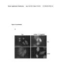 NEUTRALIZATION OF CD95 ACTIVITY BLOCKS INVASION OF GLIOBLASTOMA CELLS IN     VIVO diagram and image