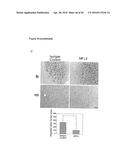 NEUTRALIZATION OF CD95 ACTIVITY BLOCKS INVASION OF GLIOBLASTOMA CELLS IN     VIVO diagram and image