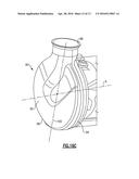 MODULAR MIXER INLET AND MIXER ASSEMBLY TO PROVIDE FOR COMPACT MIXER diagram and image