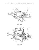 FLEXIBLE COOLING LINE ASSEMBLY diagram and image