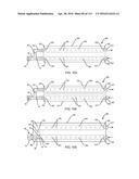 FLEXIBLE COOLING LINE ASSEMBLY diagram and image