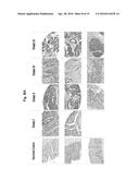 REAGENT INCLUDING ANTI-LGR6 ANTIBODIES FOR DETECTION AND DIAGNOSIS OF     CANCER diagram and image