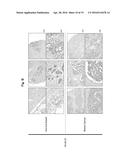 REAGENT INCLUDING ANTI-LGR6 ANTIBODIES FOR DETECTION AND DIAGNOSIS OF     CANCER diagram and image
